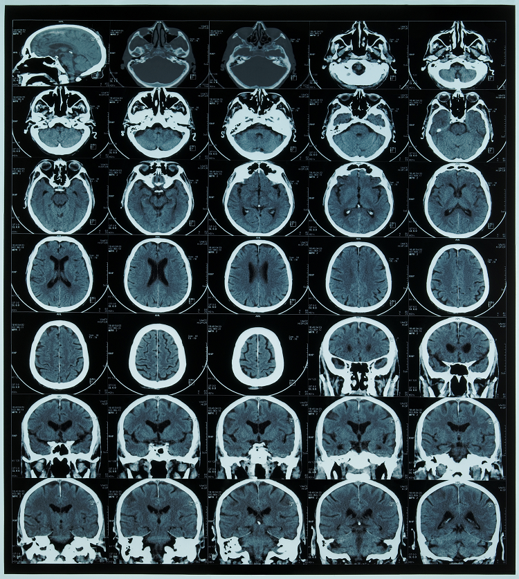 MRI Scans, CTs, X-Rays, and Ultrasounds in Evanston, WY - Star Valley ...
